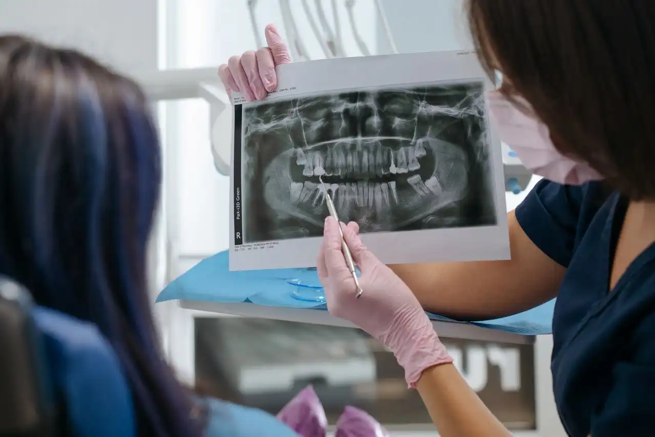 All-on-Four Dental Implants Guide For Morden