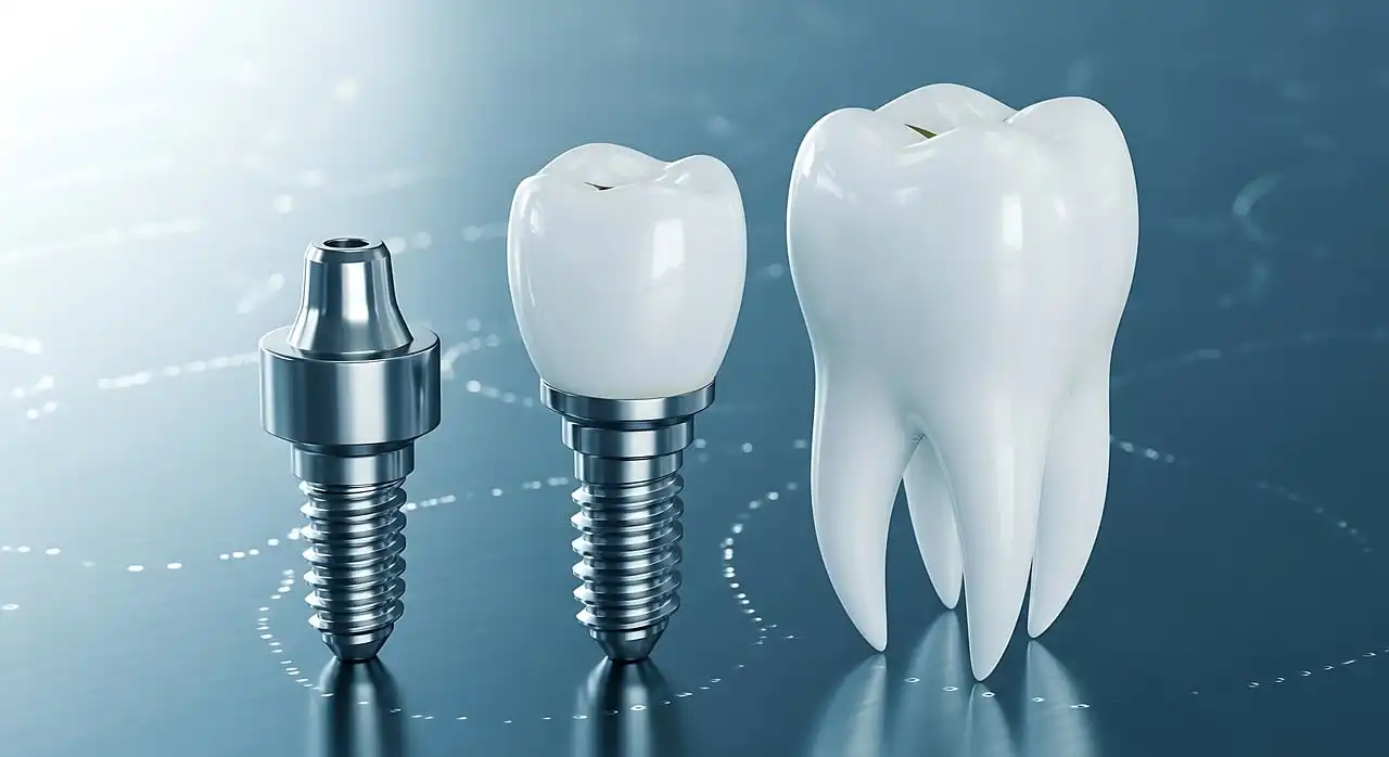 Teeth in a Day Implants in Morden: Who Is a Suitable Candidate?