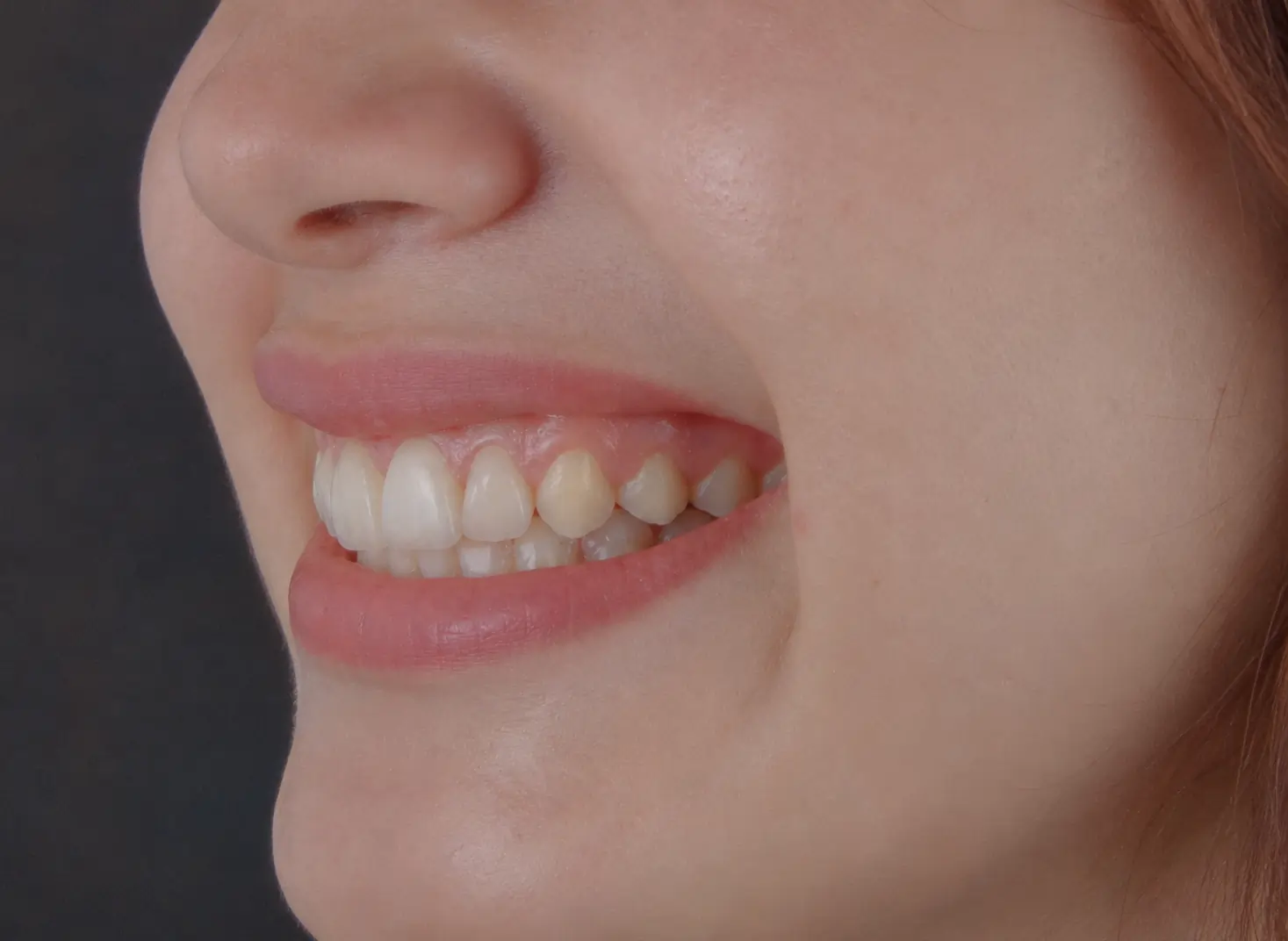 Example of a left side profile photo