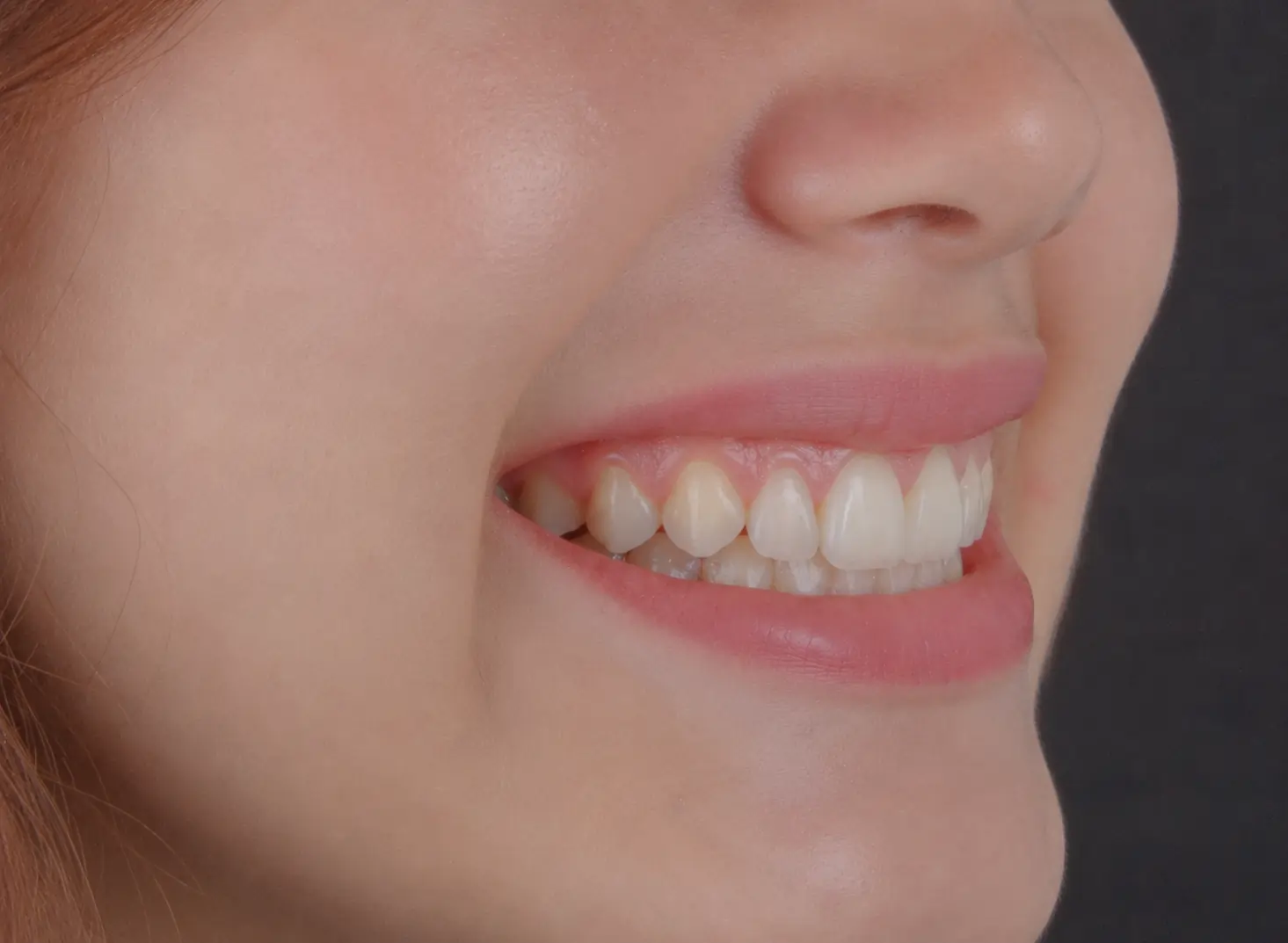 Example of a right side profile photo
